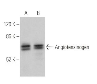western blotting image from recommended Angiotensinogen (H-12) monoclonal antibody replacement. Image 354876