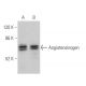This polyclonal antibody has been discontinued. See our recommended <a href="angiotensinogen-antibody-h-12">Angiotensinogen (H-12)</a> monoclonal antibody (sample data shown). western blotting image from recommended Angiotensinogen (H-12) monoclonal antibody replacement. Image 354876