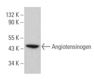 Angiotensinogen Antibody (H-12) - Western Blotting - Image 384686Each CRISPR/Cas9 Knockout (KO) Plasmid product consists of a pool of 3 plasmids designed to ensure identification and cleavage of a specific gene for maximum knockout efficiency. Each plasmid encodes a unique 20 nt sequence derived from the GeCKO (v2) library.