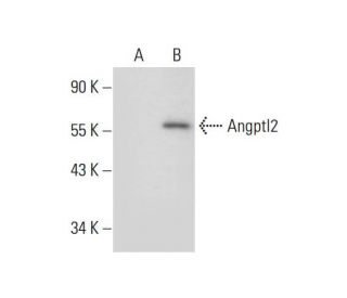 Angptl2 Antibody (H-2) - Western Blotting - Image 297929SAM Transcription Activation: SAM system utilizing dCas9-VP64, MS2-P65-HSF1, and sgRNA for precise gene transcription activation.