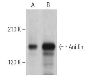 Anillin Antibody (A-2) - Western Blotting - Image 364323 