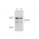 Anillin Antibody (C-7) - Western Blotting - Image 325202 
