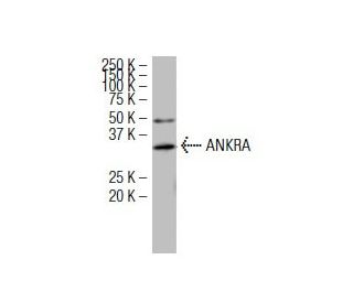 ANKRA Antibody (A26) - Western Blotting - Image 34367 