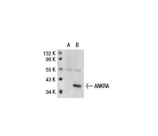 ANKRA Antibody (A26) - Western Blotting - Image 21516