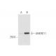 ANKRD11 Antibody (2022C8a) - Western Blotting - Image 56983 