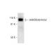 ANKRD28/44/52 Antibody (G-6) - Western Blotting - Image 291958 