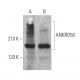 ANKRD50 Antibody (B-11) - Western Blotting - Image 371860 