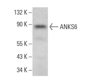 ANKS6 Antibody (A-1) - Western Blotting - Image 383726 