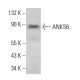 ANKS6 Antibody (A-1) - Western Blotting - Image 383726 