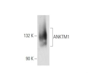 ANKTM1 Antibody (C-4) - Western Blotting - Image 80713
