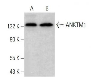 ANKTM1 Antibody (C-5) - Western Blotting - Image 381064 
