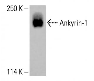 Ankyrin-1 Antibody (H-4) - Western Blotting - Image 414541