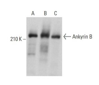 Ankyrin B Antibody (3G7) - Western Blotting - Image 376587 