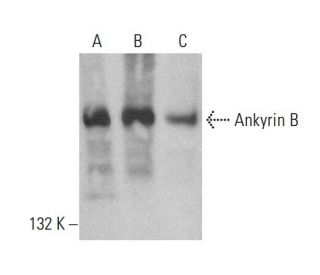 western blotting image from recommended Ankyrin B (2.20) monoclonal antibody replacement. Image 383793