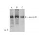 western blotting image from recommended Ankyrin B (2.20) monoclonal antibody replacement. Image 383793