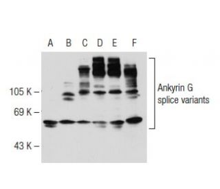 western blotting image from recommended Ankyrin G (463) monoclonal antibody replacement. Image 109666