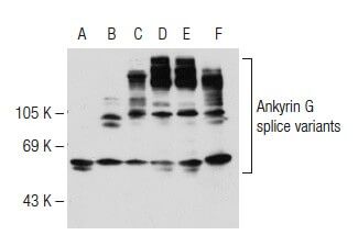 Ankyrin G Antibody (H-215) | SCBT - Santa Cruz Biotechnology