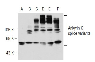 Ankyrin G Antibody (H-215) | SCBT - Santa Cruz Biotechnology Ankyrin G Antibody (H-215) | SCBT - Santa Cruz Biotechnology