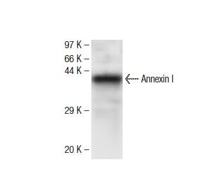Annexin I Antibody (39) - Western Blotting - Image 136752