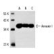 This polyclonal antibody has been discontinued. See our recommended <a href="annexin-i-antibody-eh17a">Annexin I (EH17a)</a> monoclonal antibody (sample data shown). western blotting image from recommended Annexin I (EH17a) monoclonal antibody replacement. Image 3245