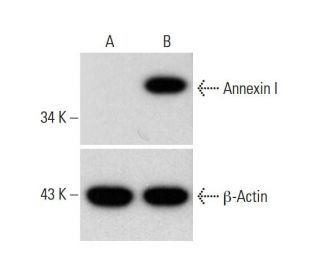 Annexin I CRISPR Activation Plasmid (h): sc-401024-ACT. Western blot analysis... 