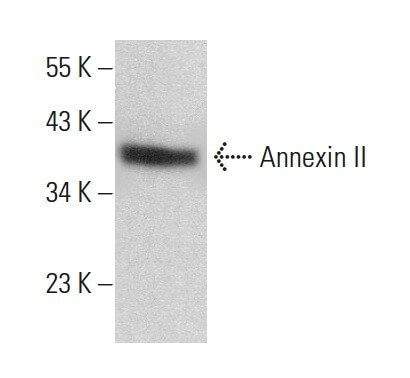 Annexin-2/ANXA2 Antibody (C-10) | SCBT - Santa Cruz