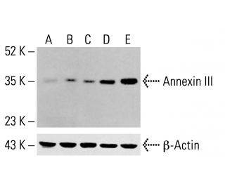 Annexin III Antibody (21) - Western Blotting - Image 413388 