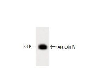 Annexin IV Antibody (4) - Western Blotting - Image 60235 