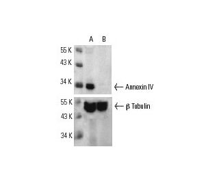 Annexin IV siRNA (h): sc-29684. Western blot analysis of Annexin IV expression in non-transfected control (A) and Annexin 