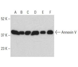 Annexin V Antibody (130) - Western Blotting - Image 398127 