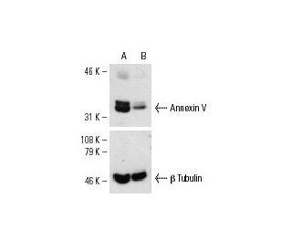 Annexin V siRNA (h): sc-29686. Western blot analysis of Annexin V expression in non-transfected control (A) and Annexin V 