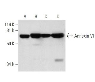 western blotting image from recommended Annexin VI (E-5) monoclonal antibody replacement. Image 291041