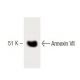 Annexin VII Antibody (5) - Western Blotting - Image 60236 