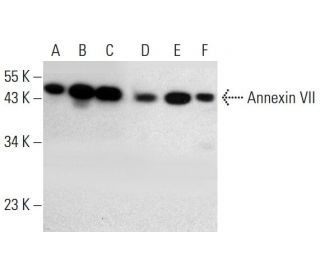 Annexin VII Antibody (G-8) - Western Blotting - Image 384520 