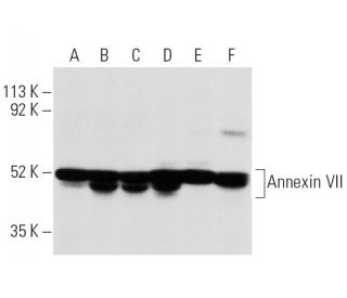 western blotting image from recommended Annexin VII (A-1) monoclonal antibody replacement. Image 6619