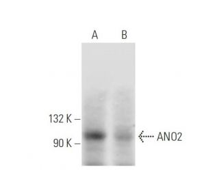 ANO2 Antibody (D-2) - Western Blotting - Image 291842SAM Transcription Activation: SAM system utilizing dCas9-VP64, MS2-P65-HSF1, and sgRNA for precise gene transcription activation. 