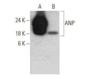 western blotting image from recommended ANP (F-2) monoclonal antibody replacement. Image 358546