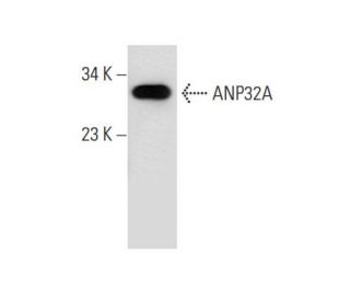 ANP32A Antibody (A-182) - Western Blotting - Image 67971 