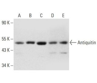 Antiquitin Antibody (A-7) - Western Blotting - Image 317967 