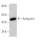 Antiquitin Antibody (A-7) - Western Blotting - Image 367730 