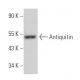 Antiquitin Antibody (A-7) - Western Blotting - Image 367736