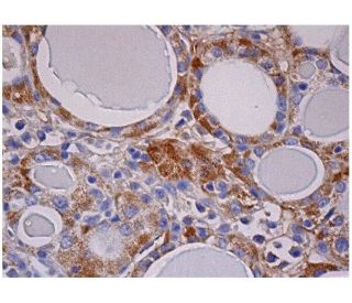 Antiquitin Antibody (D-7) - Immunohistochemistry - Image 284704 