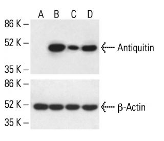 Antiquitin Antibody (D-7) - Western Blotting - Image 411281