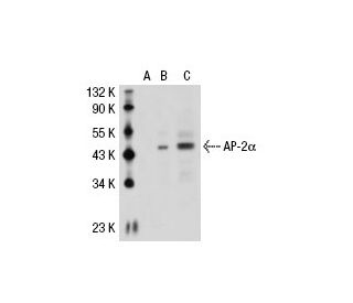 AP-2α Antibody (G8/5) - Western Blotting - Image 30257
