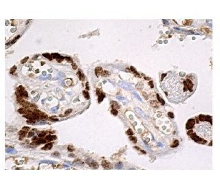 AP-2α Antibody (3B5) | SCBT - Santa Cruz Biotechnology