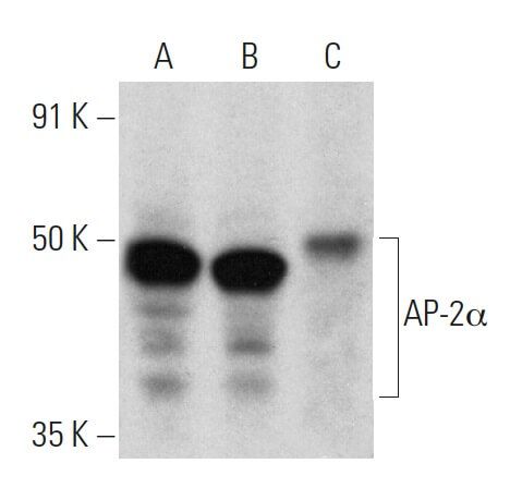 Anti-AP-2α Antibody (3B5) | SCBT - Santa Cruz Biotechnology