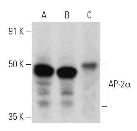 ap-2alpha-antibody-3b5-western