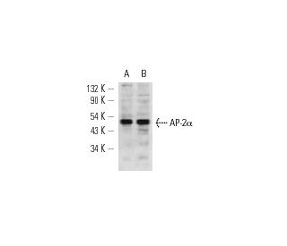 AP-2&alpha; Antibody (G8/5) - Western Blotting - Image 12829 