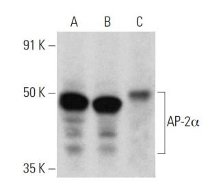 western blotting image from recommended AP-2&alpha; (3B5) monoclonal antibody replacement. Image 354842