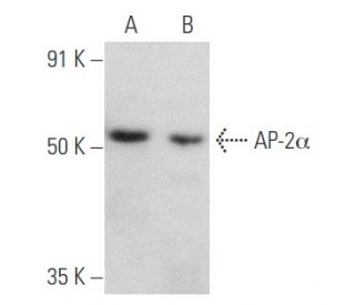 AP-2&alpha; Antibody (D-12) - Western Blotting - Image 354843 